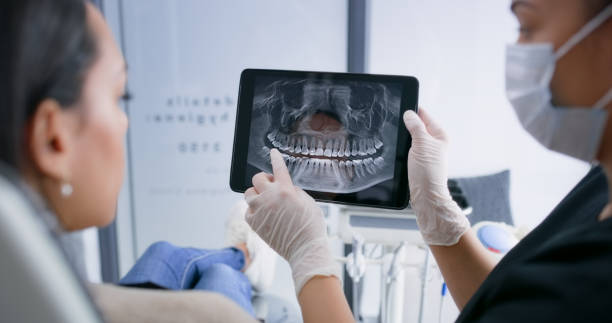 Licensed Wisdom Tooth Removal service in Tripp County County, SD - Smile Center Dentistry